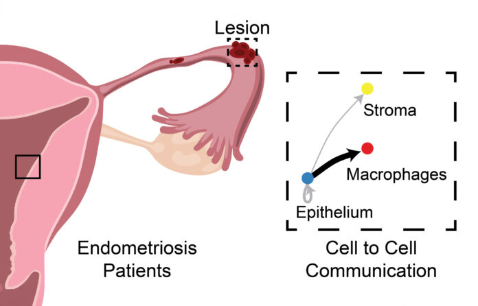 Researchers-make-progress-toward-non-hormonal-treatment-for-endometriosis.jpg