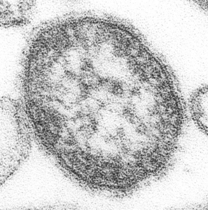 Measles-virus-detected-in-Houston-wastewater-before-cases-were-reported.jpg